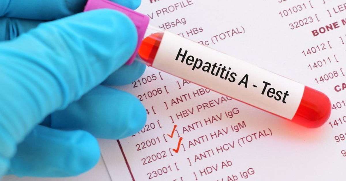 monsoon season rise water borne diseases hepatitis how to control