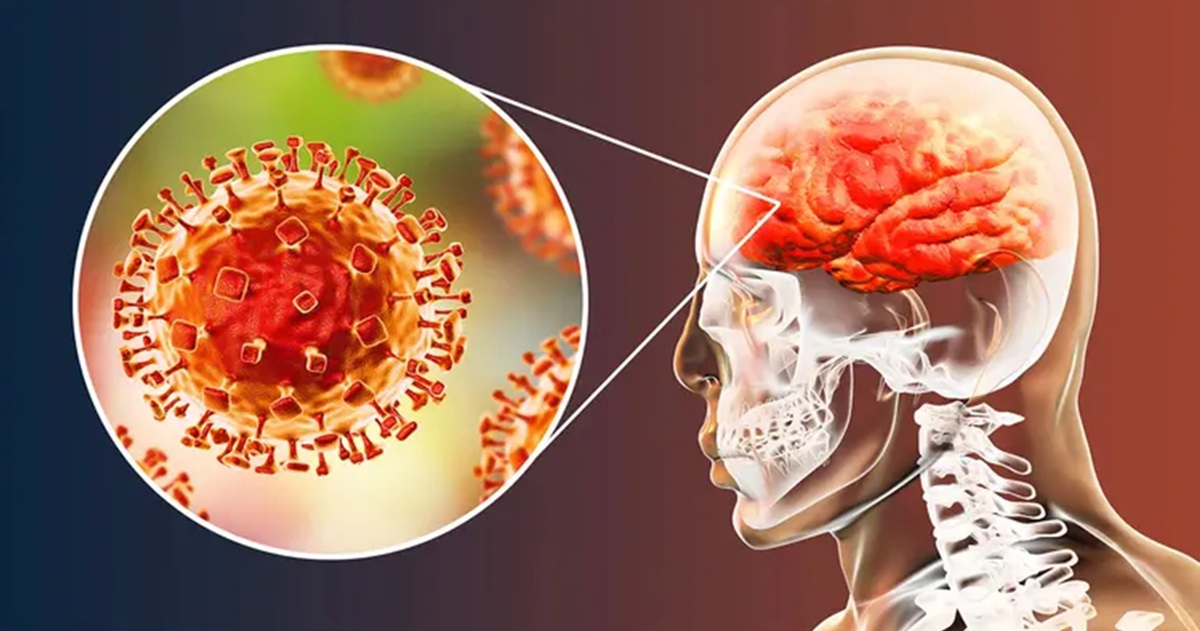 encephalitis rising 50 percent cases in east india causes outbreak symptoms how to control treatment